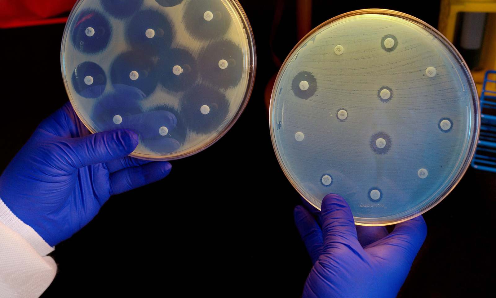 AI 发现新种抗生素有效杀灭超级细菌